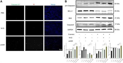 Vitamin D Receptor Genetic Polymorphisms Associate With a Decreased Susceptibility to Extremity Osteomyelitis Partly by Inhibiting Macrophage Apoptosis Through Inhibition of Excessive ROS Production via VDR-Bmi1 Signaling